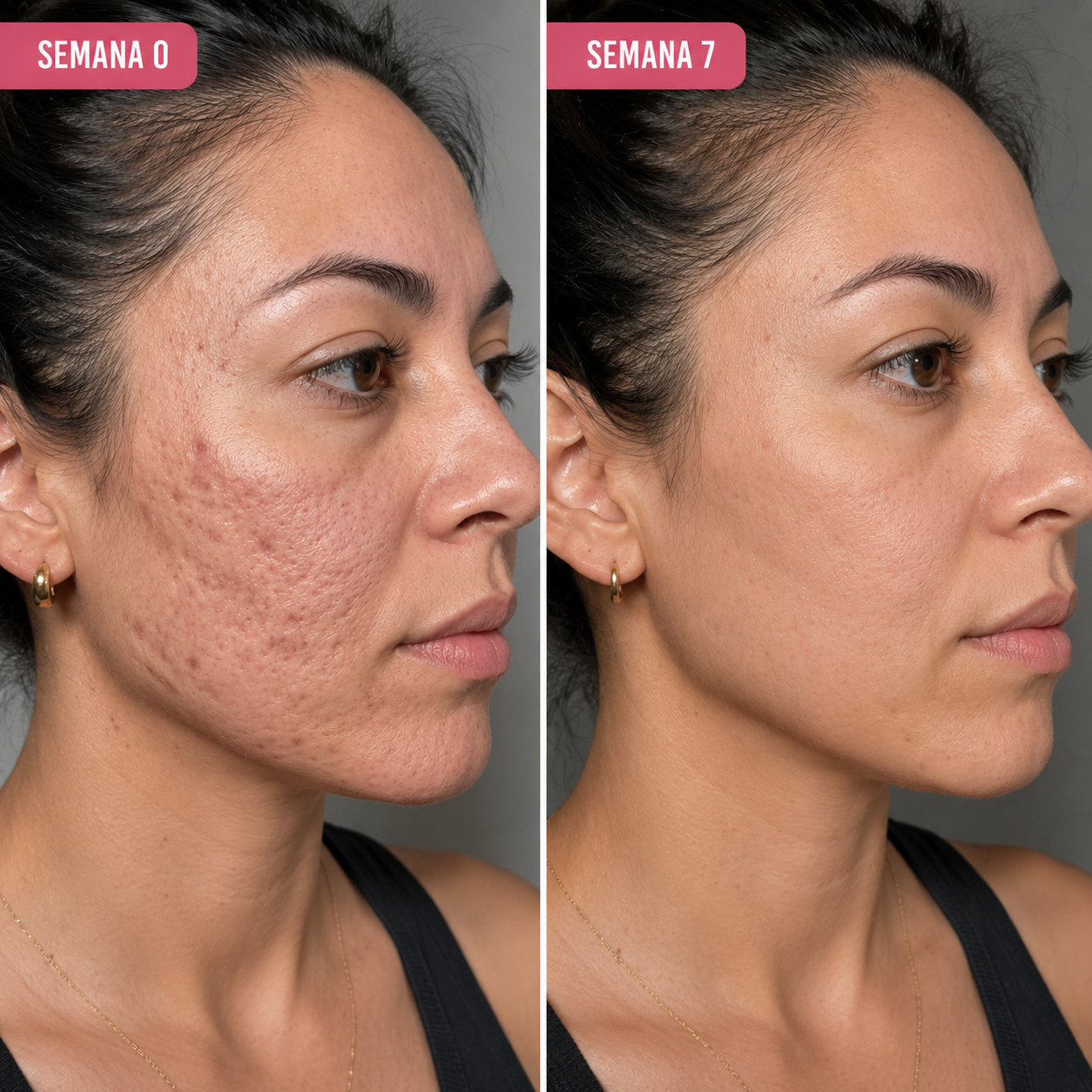 HERBEAUTY STICK - RECUPERE SU PIEL UNIFORME, BELLA Y SIN COMPLEJOS EN 49 DÍAS