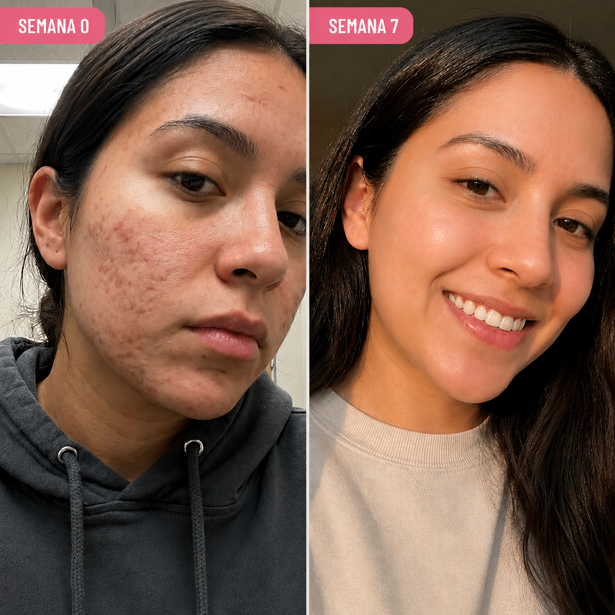 HERBEAUTY STICK - RECUPERE SU PIEL UNIFORME, BELLA Y SIN COMPLEJOS EN 49 DÍAS
