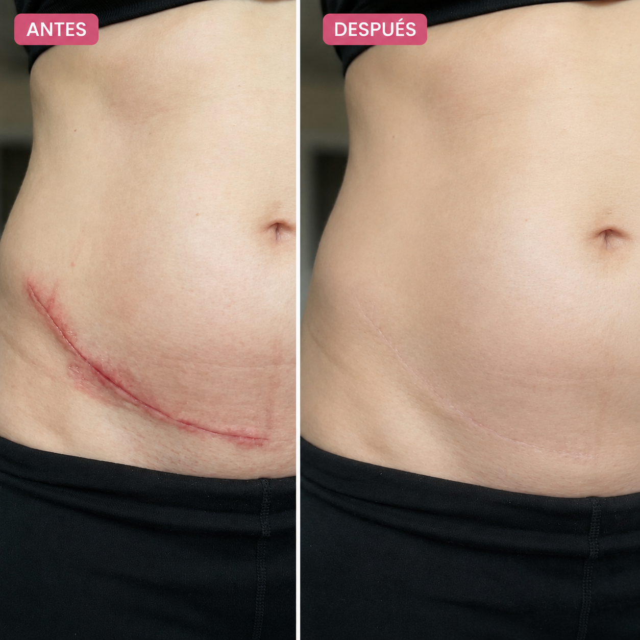 HERBEAUTY - RECUPERE SU PIEL UNIFORME, BELLA Y SIN COMPLEJOS EN 49 DÍAS