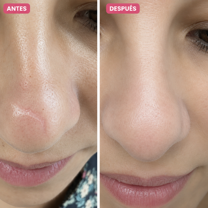 HERBEAUTY - RECUPERE SU PIEL UNIFORME, BELLA Y SIN COMPLEJOS EN 49 DÍAS